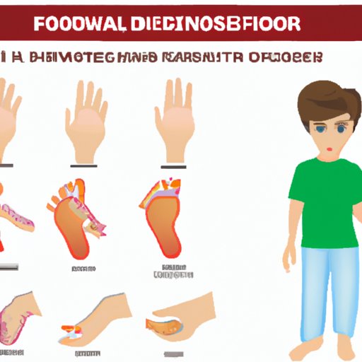 II. Understanding the Causes of Hand Foot and Mouth Disease