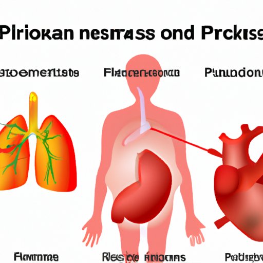 III. Risk Factors for Pneumonia