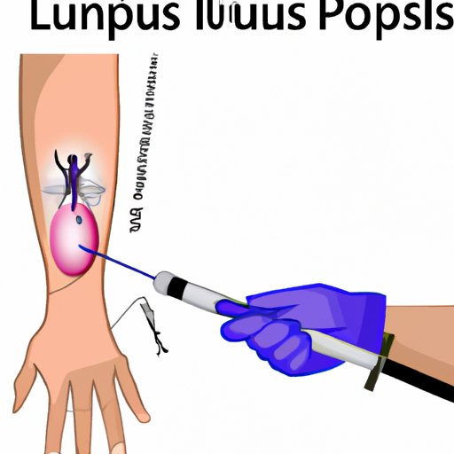 IV. How Doctors Use Physical Exams to Diagnose Lupus