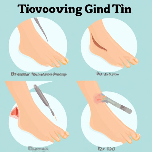 IV. Comprehensive Guide to Fixing Ingrown Toenails