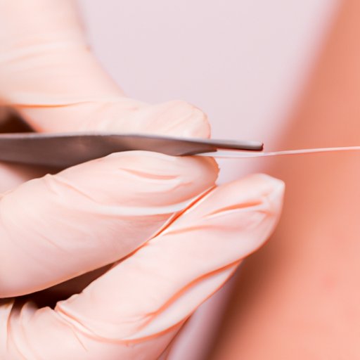 IV. Using Tweezers for Ingrown Hairs