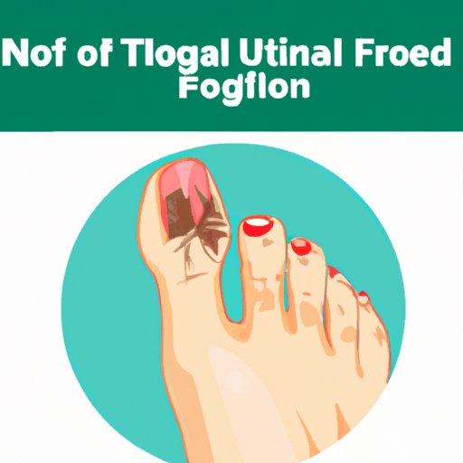 VII. What to Expect When Your Toenail Fungus Is Finally Dying