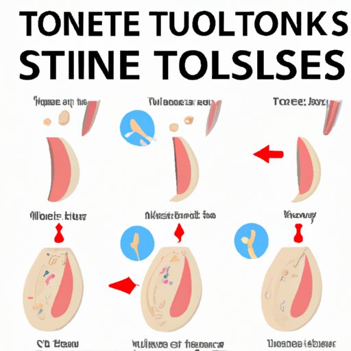 How to Make Tonsil Stones Fall Out: The Ultimate Guide