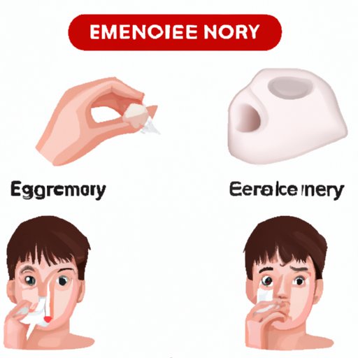 VI. Emergency First Aid: What to Do When You Have a Nosebleed