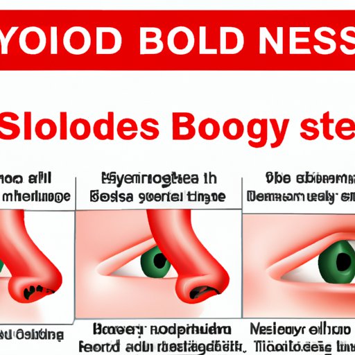 Understanding the Causes of Bloody Nose and How to Prevent Them