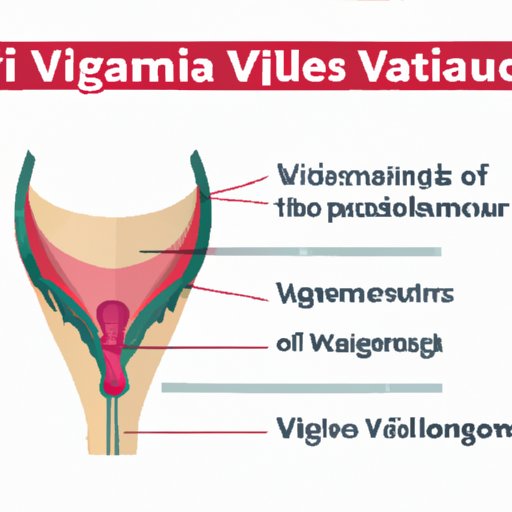 Understanding the Symptoms of Vulvovaginitis: A Comprehensive Guide to Diagnosis and Treatment