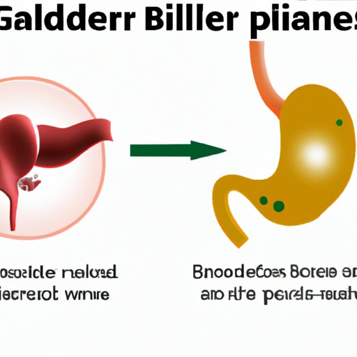 Understanding Gallbladder Pain and How to Alleviate it