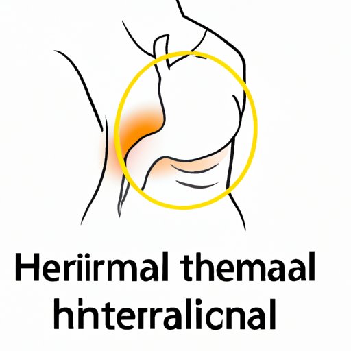 III. How to Identify and Treat Symptoms of Hiatal Hernia