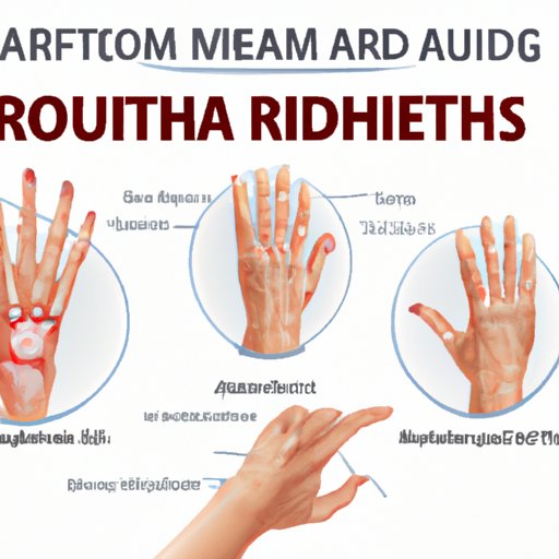 How to Recognize the Signs of Rheumatoid Arthritis: A Guide for Patients