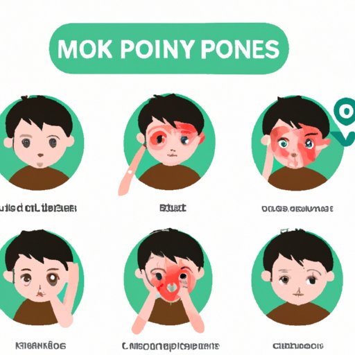  A Guide to Identifying Monkeypox Symptoms in Humans 